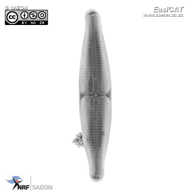© SAEON Craspedostauros capensis SEM001 image.jpg